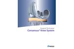 Consensus - Knee System - Brochure
