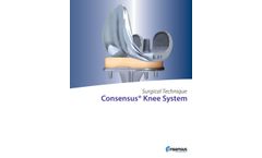 Consensus - Knee System - Brochure