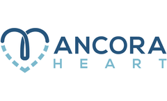 Ancora Heart Receives Breakthrough Device Designation from FDA for the AccuCinch Ventricular Restoration System