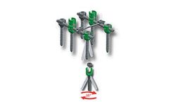 Andes - Model 6.0 - Spinal Fixation System