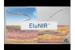eDES by Medinol - Video