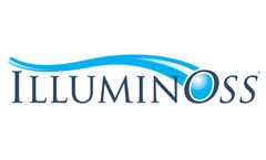 Preliminary Data Presented from First U.S. Clinical Trial of IlluminOss Medical`s Photodynamic Bone Stabilization System