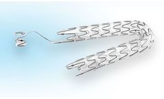 Allium - Ureteric Stents