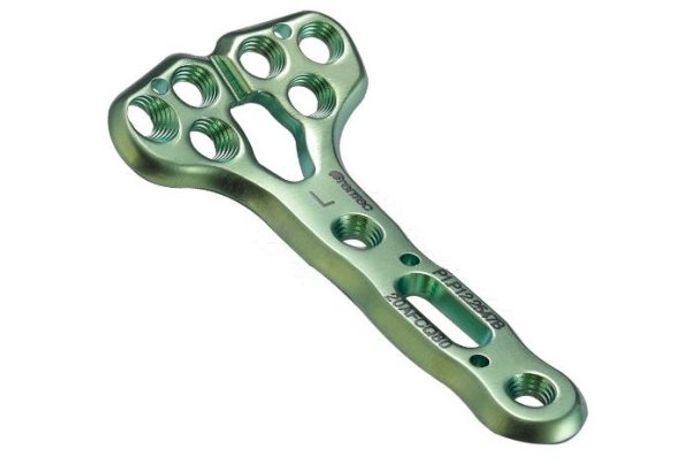CORENTEC Optirad Volar Plate System