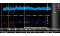 Finapres NOVA - Measurement Review Software