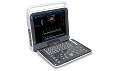 Biocare - Model iMage T6 - Color Doppler Ultrasound Platform