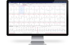AT-Report - AI-Based Accurate ECG Analysis Software