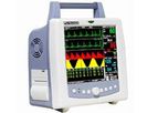 Smartizon - Model SPC-500B - Multi-Parameter Patient Monitor