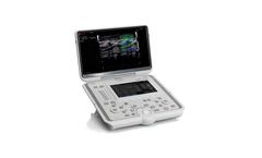 Esaote MyLab - Model Omega - Portable and Multidisciplinary Ultrasound Unit
