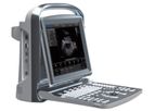 Chison - Model ECO1 Vet - Portable Ultrasound