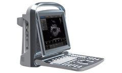 Chison - Model ECO1 Vet - Portable Ultrasound