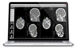AlleRad - Version Rbox - Teleradiology Software for Radiology Image Sharing