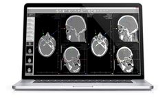 AlleRad - Version Rbox - Teleradiology Software for Radiology Image Sharing