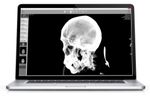 AlleRad - Version DICOM Reader-EXHB - Medical Imaging Software