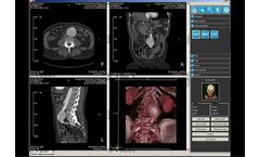 IMAGE - Version iQ-3D - Post-Processing Workstation Software