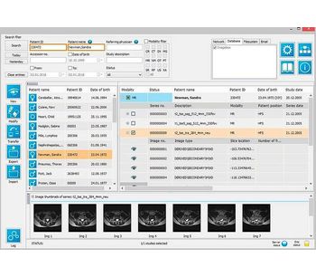 IMAGE - Version iQ-VIEW/PRO - Radiology Reading Station Software