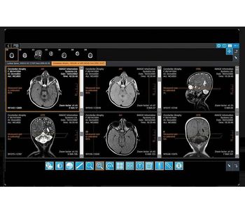 IMAGE - Version iQ-4VIEW - Web-Based Diagnostic Zero-Footprint Viewer Software
