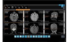 IMAGE - Version iQ-4VIEW - Web-Based Diagnostic Zero-Footprint Viewer Software