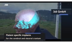 Patient-specific implants from 3di- Video