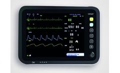 Model YK-8000C - Multi-Parameter Patient Monitor
