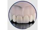 INDURATE - Model ML CT - Multilayer Combinate Translucent for Dental Restoration