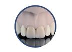 INDURATE - Model ML ET - Multilayer Extra-Translucent for Dental Restoration