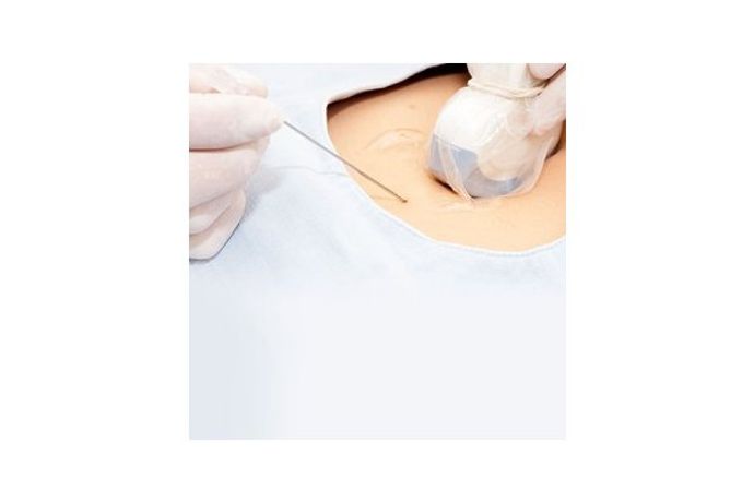 Exact Medical - Probe Covers