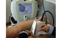 Vascular Laser Treatment with Exotherme - Video