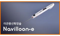Navilloon-e Eustachian Tube Balloon Catheter, Mega Medical - Video