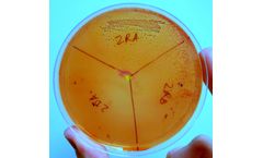 Microorganisms Remediation Services
