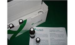 NZYTech - Model AK00051 - Acetaldehyde, UV Method
