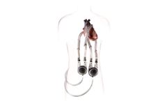 EXCOR - Model Adult - Mechanical, Pulsatile Heart Support System