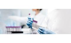 Lab Testing Consolidation Services