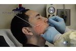 Nasopharyngeal Swab Procedure - Video