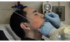 Nasopharyngeal Swab Procedure - Video