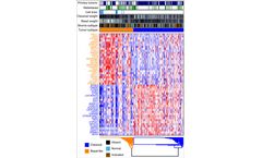 GeneCentric - Pancreatic Cancer Subtype Profiler (PurIST)