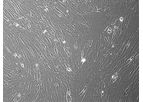 Vitro - Human Placenta Derived MSCs: 500,000 Cells Per Vial