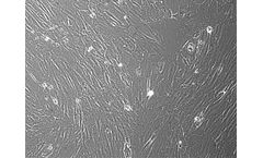 Vitro - Model CAF02 - Human Ovarian Serous Cancer Associated Fibroblasts: 1,000,000 Cells Per Vial