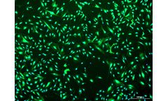 Vitro - Human Prostate Cancer Associated Fibroblasts: 1,000,000 Cells Per Vial
