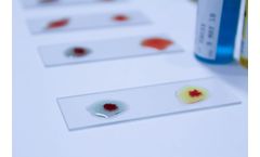 Blood Grouping Reagents