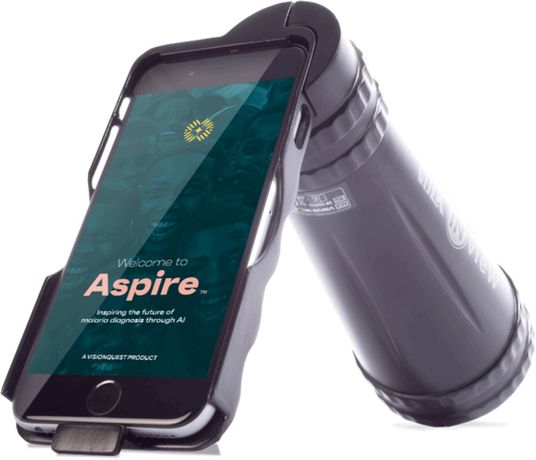 Aspire - AI Software for built to Detect Malarial Retinopathy