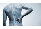 Stem Cell Therapy for Back Pain