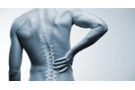 Stem Cell Therapy for Back Pain