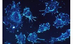AIVITA - Cancer Immunotherapy