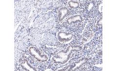 Huabio - Model ST05-25 -ET1609-67 - HIF-1 Beta Recombinant Rabbit Monoclonal Antibody