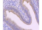 Huabio - Model 13 -R1601-8 - Cytokeratin Rabbit Polyclonal Antibody