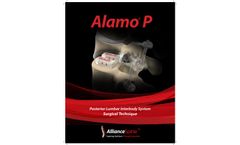 Alamo - Model P - Posterior Lumbar Intervertebral Device - Brochure