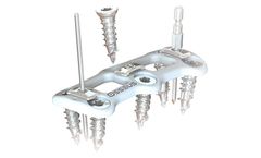 Osseus - Model White Pearl ACP - Pioneering Cervical Spine Fixation System