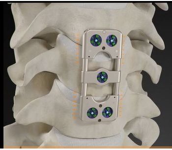 Dynamic Plates System-1