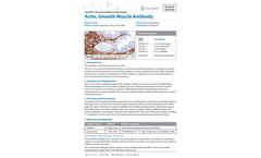 GeneAb - Model IHC506 - Actin, Smooth Muscle Antibody Datasheet